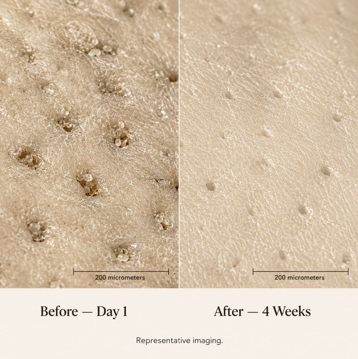 Pore-Refining Serum