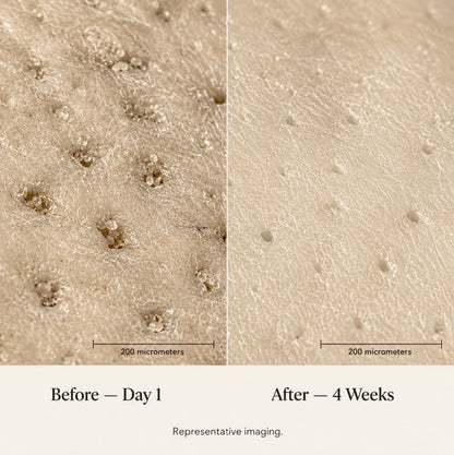 Pore-Refining Serum