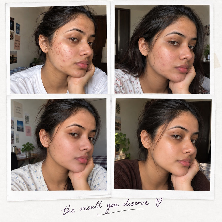 Pore-Refining Serum