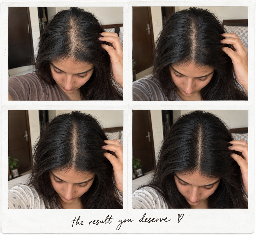 Scalp Density Serum